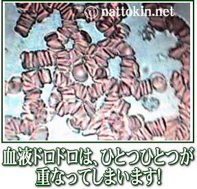 ibgELlbgŌtTT