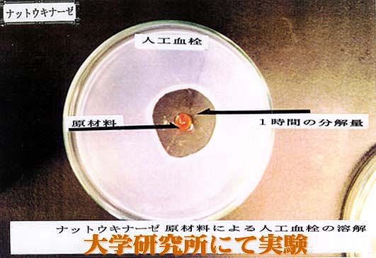 商品に含まれているナットウキナーゼの１時間の血栓分解量