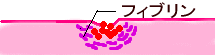 Ì